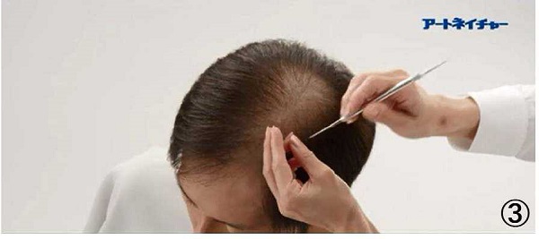 アートネイチャーの動き商標３