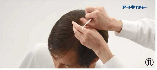 アートネイチャーの動き商標１１